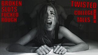 Disfigured University Stories - college-aged and boned up - Part four